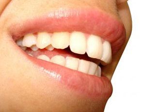 home remedies for whitening teeth overnight